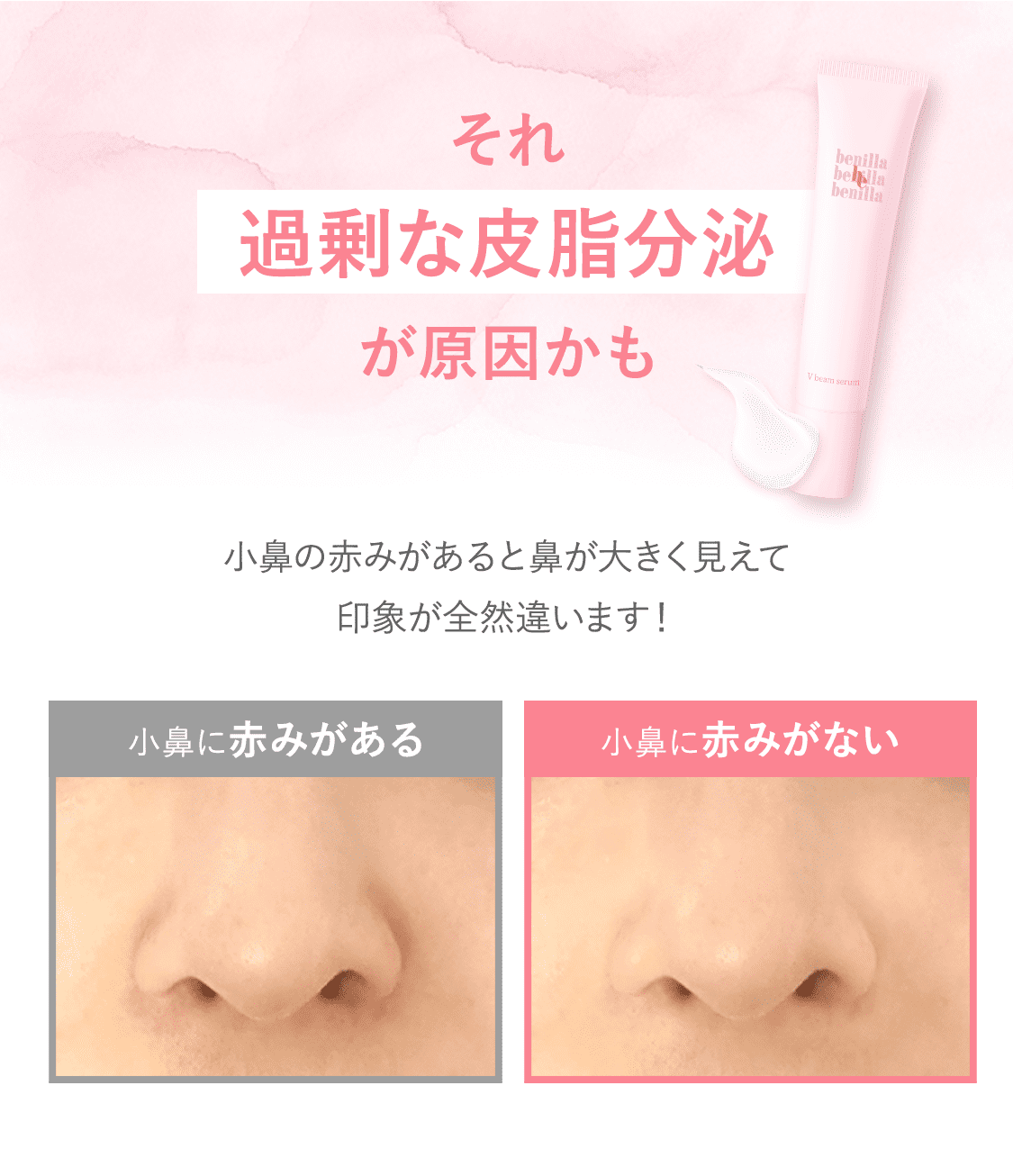benilla　Vbeam serum 【アゼライン酸配合】スポット美容液